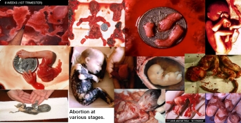 Aborted-fetus-debate-29123384-1595-817